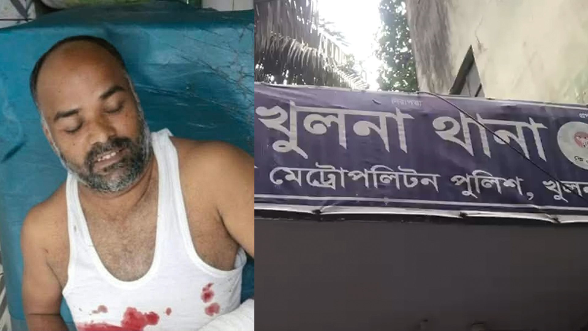 খুলনায় ছিনতাইকারীদের চাপাতির কোপে পুলিশ পরিদর্শক আহত